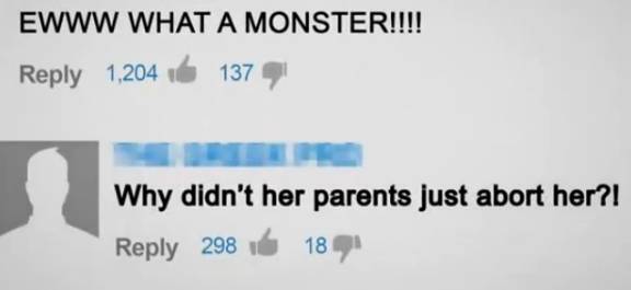 世界最丑女人 怎么吃都不会胖