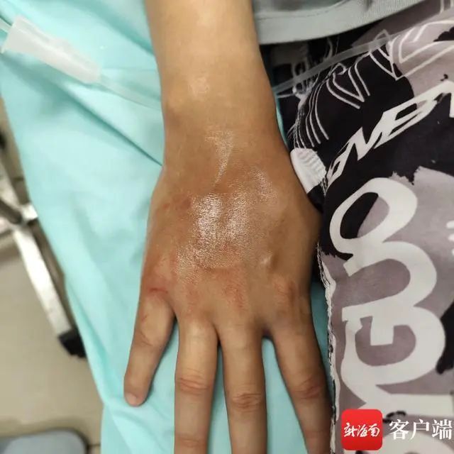 有剧毒！看到立即远离，千万别碰这种“塑料袋”！